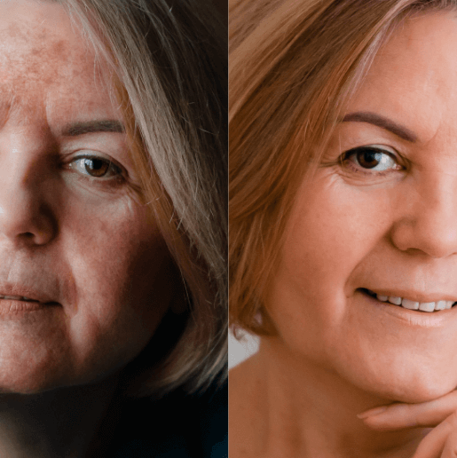 Before and after image showing the visible transformation in skin appearance after using the FlowMist™ filtered showerhead, highlighting improved skin hydration and radiance