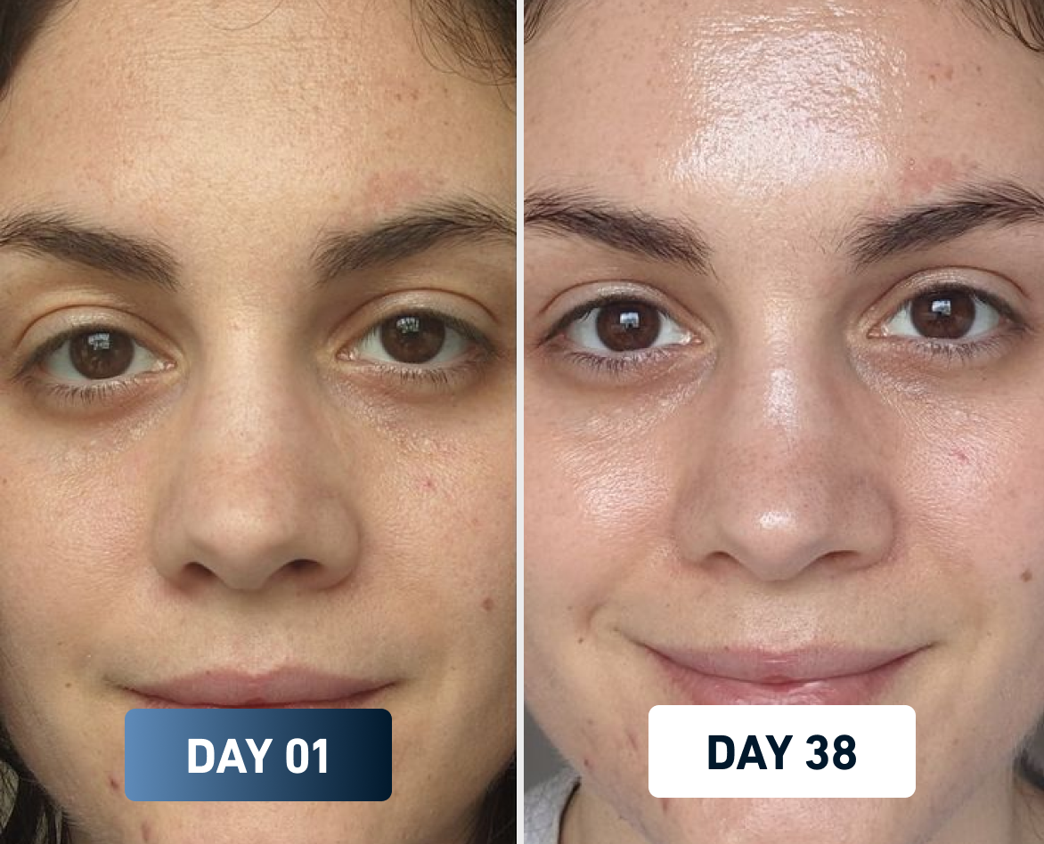 FlowMist shower filter results on skin texture and softness – female user transformation